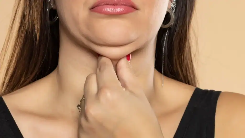 An image of a woman with double chin, sad, worried : Non Surgical Double Chin Removal Treatment in Ampthill, UK