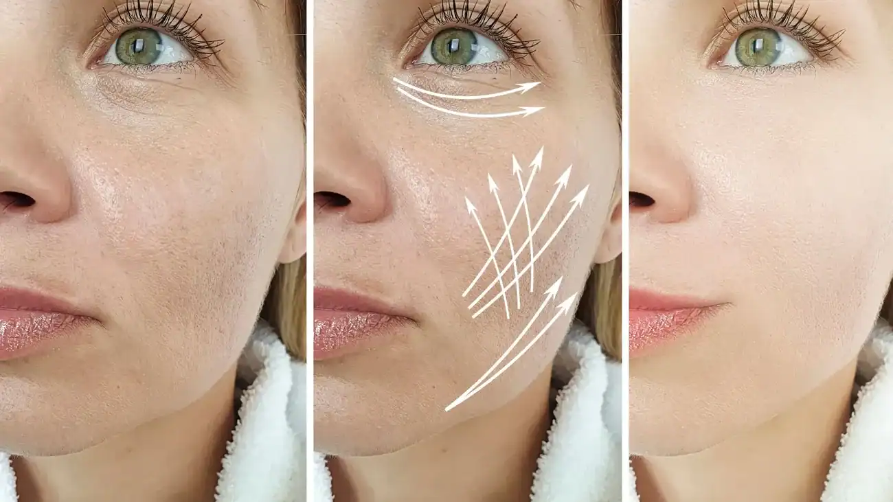Can One Treatment Really Tackle More Than One Skin Concern Ampthill?
