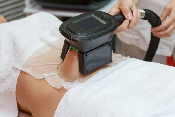 Image of person having fat freezing treatment to help weight gain Ampthill