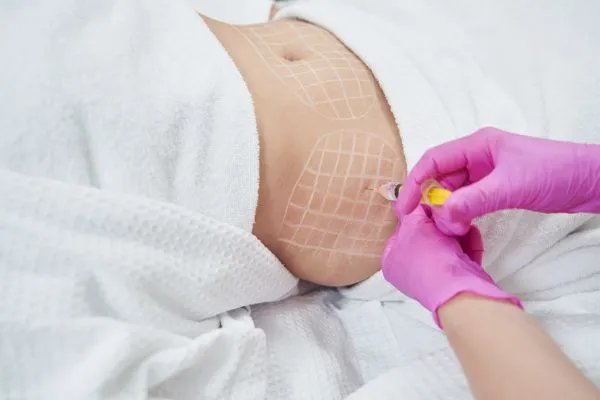 image of fat dissolving injections on love handles to help combat weight gain Ampthill