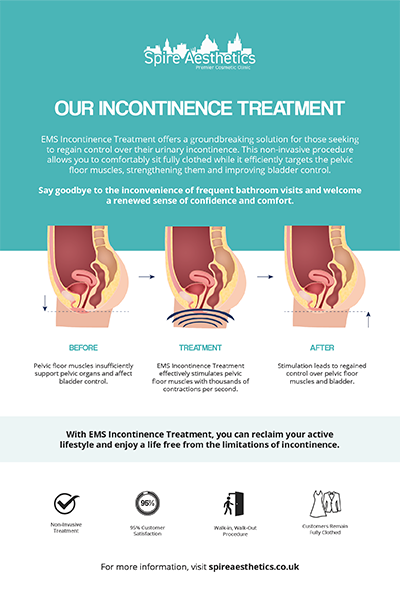 image to show how EMS treatment works for female urinary incontinence Ampthill