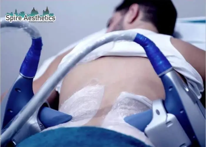 Man having fat freezing treatment done on love handles before a competitions Ampthill to create a sculpted look.