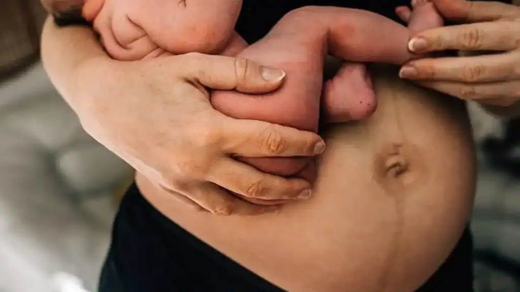 Why Is My Stomach Still Big After Pregnancy Ampthill?